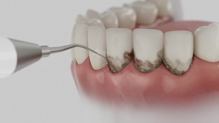 Trusted Tooth Extraction service in Fairfield, AL - Dentist Open Now